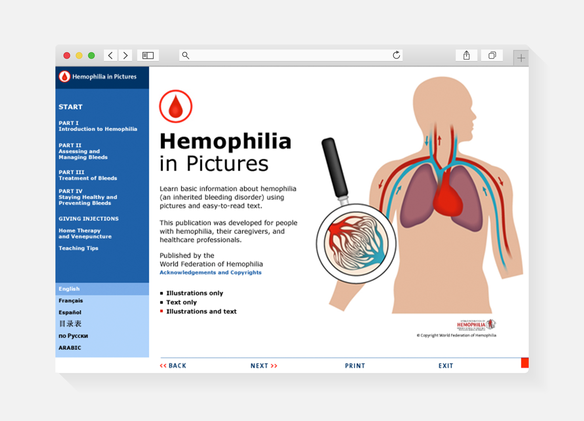 Hemophilia in Pictures website
