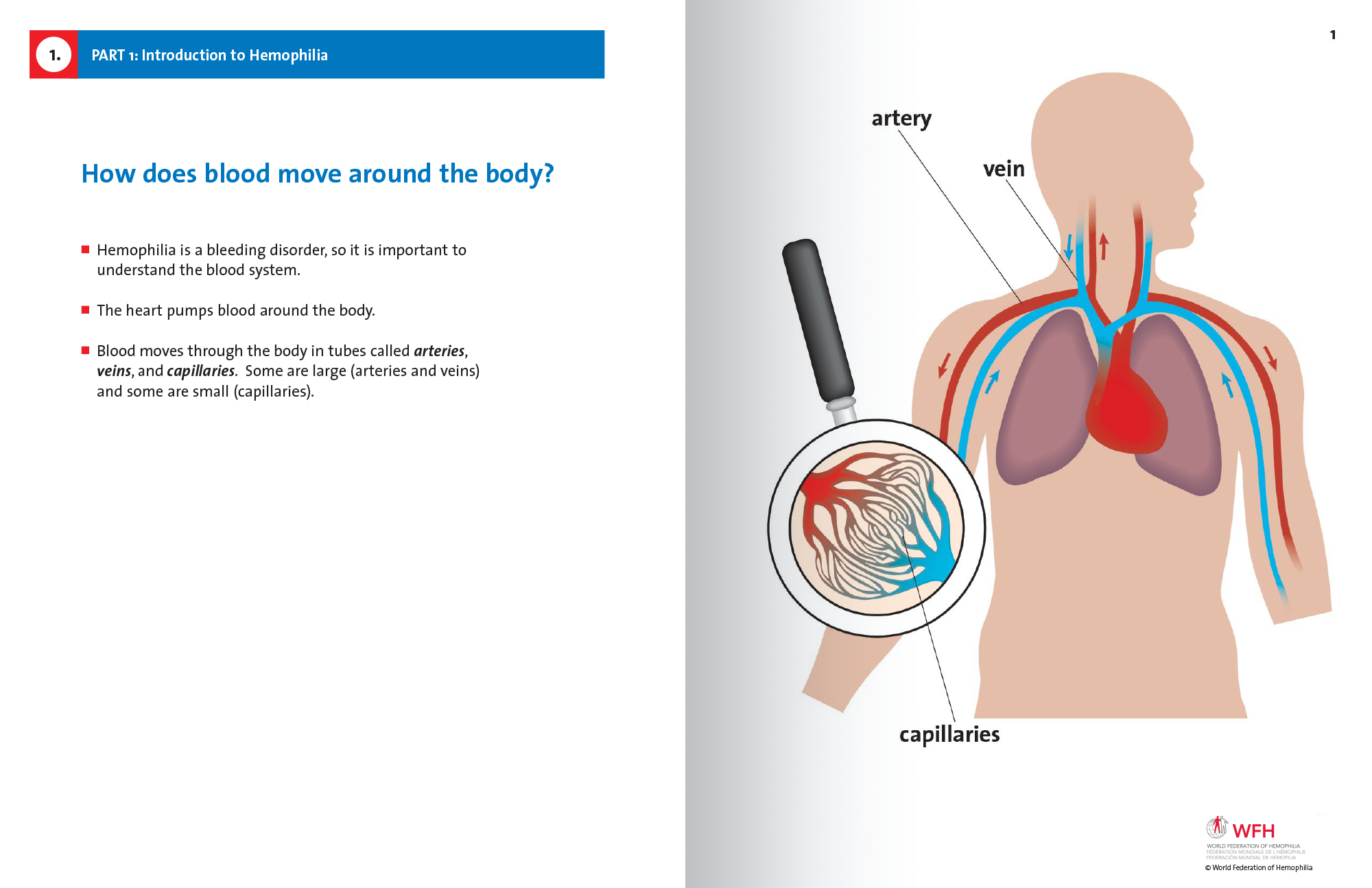 Hemophilia in Pictures spread