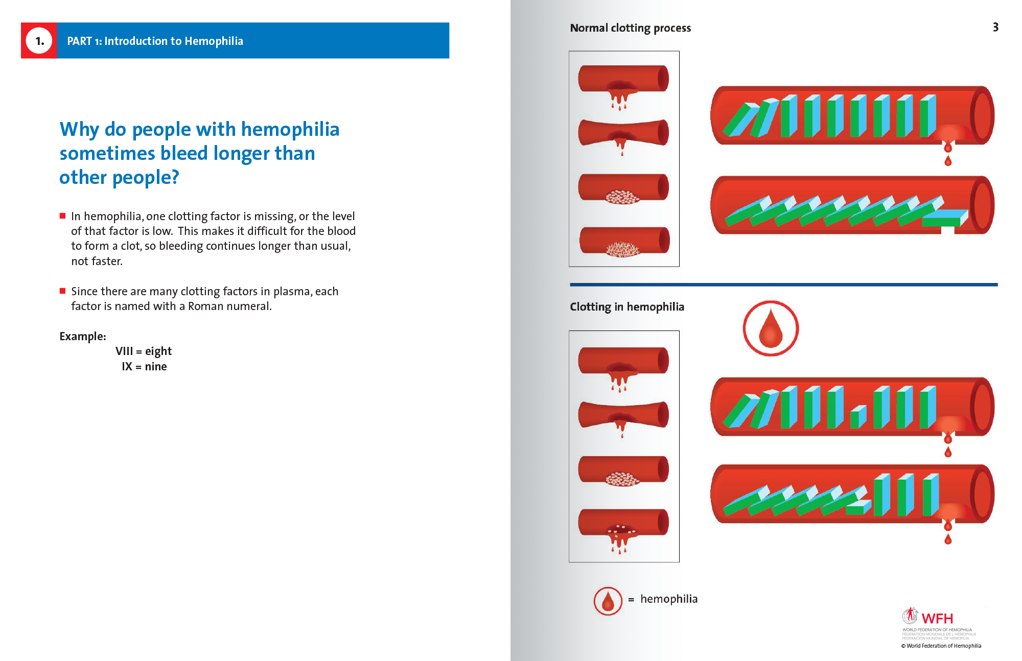 Hemophilia in Pictures spread