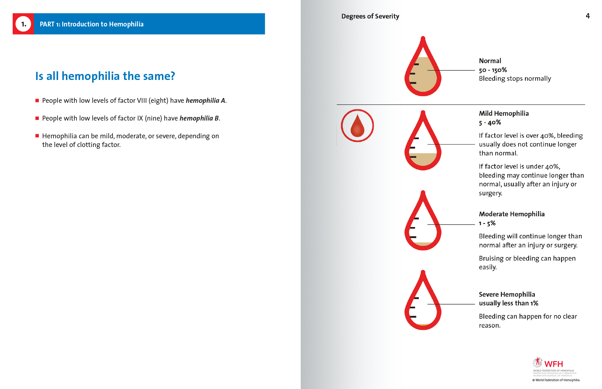 Hemophilia in Pictures spread