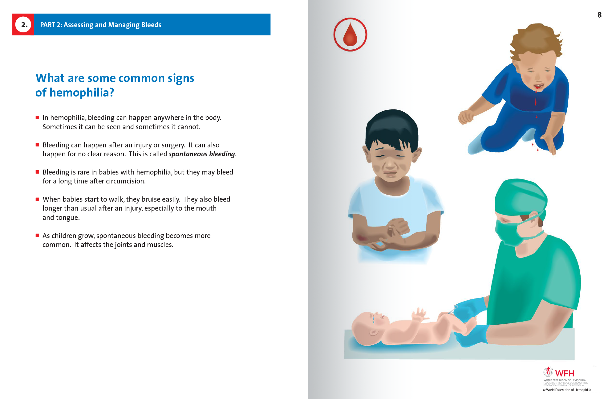 Hemophilia in Pictures spread